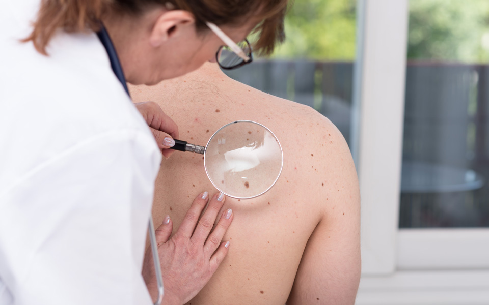 Photo shows a female doctor wearing glasses and holding a magnifying glass to a persons back to check their skin.